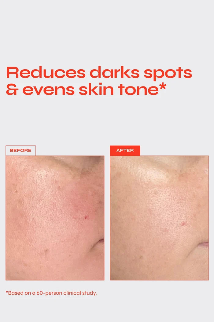 BRIGHTEN - Targeted Pigment Serum Apothecary Facile
